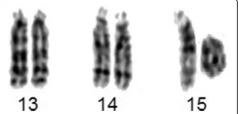 Fig. 1 Partial karyotype showing ring chromosome 15,i.e. r(15)(p11.2q26)
