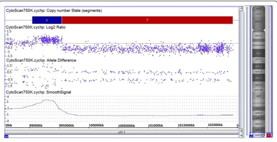 Fig. 3 Partial karyotype showing comprehensive characterization of thechromosome ring15 in the proband’s karyotype and was identified as46,XY,r(15)(p11.2q26),ish r(15)(p11.2q26)(RP11-654A16++)(subtel15qter-)