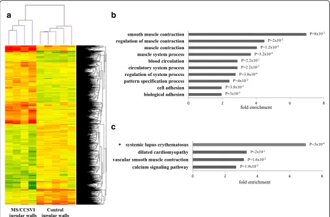 Fig. 1 Transcriptomic analysis in internal jugular vein walls.column represents one RNA sample (MS/CCSVI and control jugular walls) and each row represents one gene (probe)