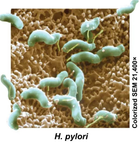 Figure 21.9_1 H. pylori Colorized SEM 21,400×