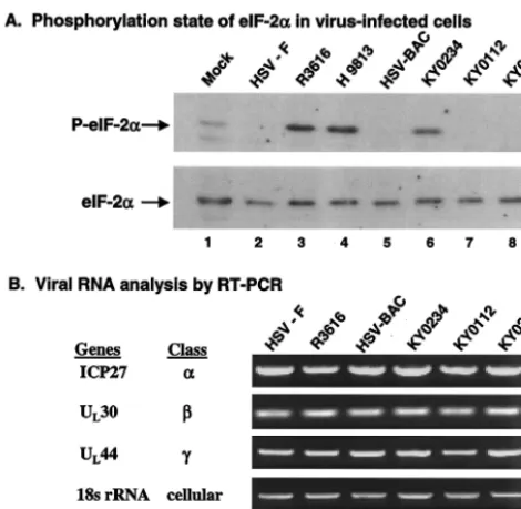 FIG. 5. (A) Phosphorylation state of eIF-2�the same membrane (Cell Signaling Tech, Inc.)