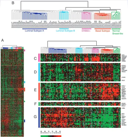 Fig. 1.Hierarchical clustering of 115 tumor tissues and 7 nonmalignant tissues using the ‘‘intrinsic’’ gene set