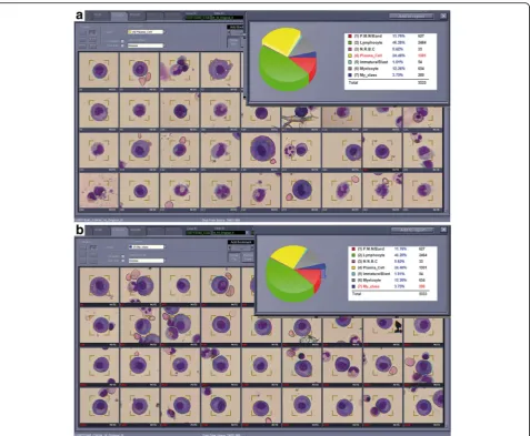 Fig. 1 a From 5333 cells that were captured on this particular MGG stained slide, the image capture and analysis system automatically assigned1301 cells to the plasma cell category