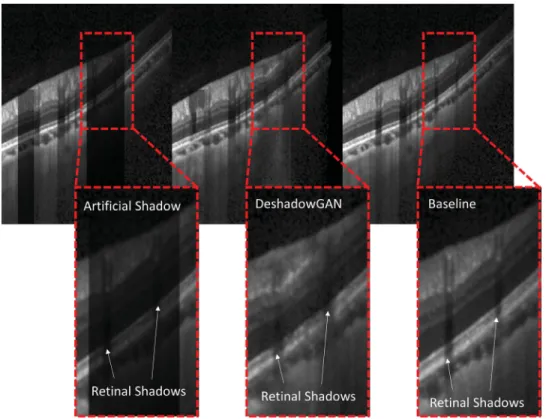 Figure 9. Artificial shadow removal experiment results. From left, the baseline with an artificial shadow, a deshadowed image from Deshad- Deshad-owGAN, and a baseline image without an artificial shadow.