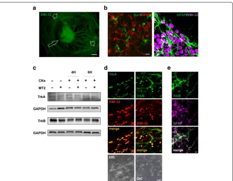 Fig. 1 TrkA/B receptor expression in organotypic spinal cord cultures.GFAP in the ventral horns