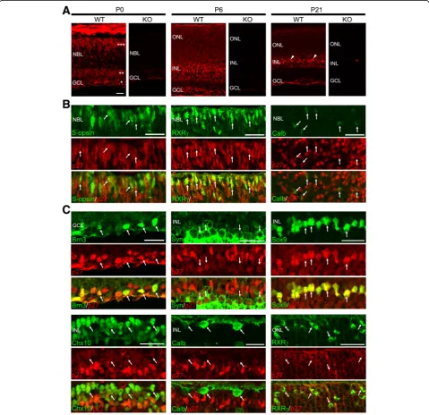 Fig. 1 Cellular localization of p27 in the mouse retina during postnatal development.Arrows indicate colocalization