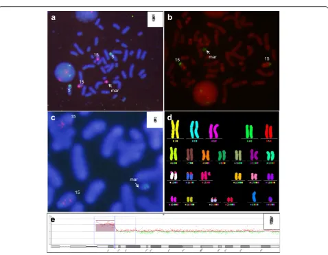Fig. 2 a Karyotype of the patient’s father showing 46,XY,t(12;18)(p10;p10); b M-FISH analysis demonstrated that sSMC was structured fromchromosome 12 and 18 in case 2