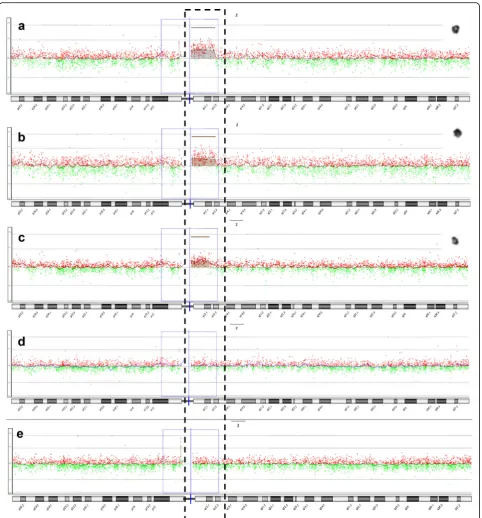Fig. 5 Array CGH analysis profiles of sSMC(2)s. a Array CGH detected a gain of 12.6 Mb derived from chromosome 2q11.1q12.3 (chr2:95,529,039-108,083,956) (case 12); b Identical duplication shown in her mother; c De novo 9.8 Mb gain of chromosome 2q11.1q12.1