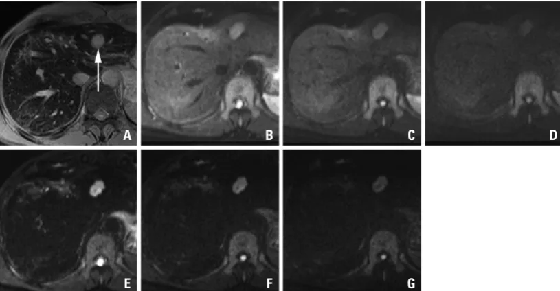 Fig. 3. Mean confidence scores with standard deviations of each MRI sequence for 1 cm or larger lesions