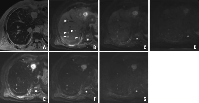 Fig. 4. Mean confidence scores with standard deviations of each MRI sequence for lesions smaller than 1 cm