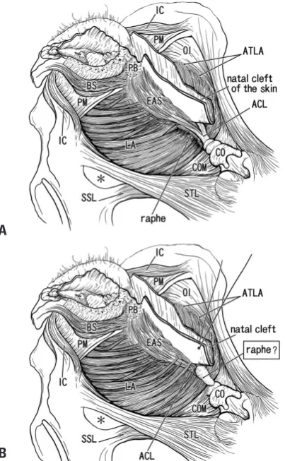 Fig. 6A displays one of the classical concepts of the liga-
