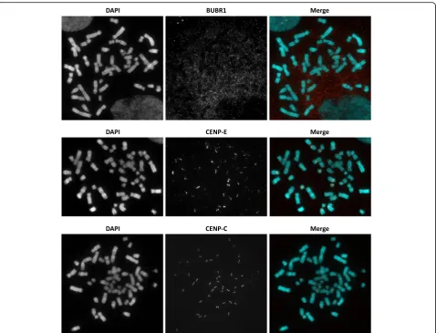 Fig. 1 Active centromere antibody screening on methanol-acetic acid fixed cells. Representative images of immunocytochemistry using TEEN andKB buffer performed on HCT-15 cells stored in methanol-acetic acid fixative