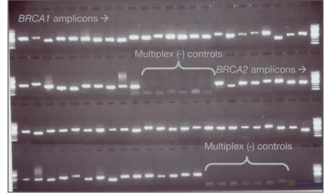 Figure 2. Agarose Gel Showing Amplification of the Amplicons for BRCA1 and BRCA2 Analysis