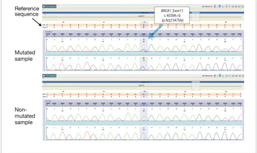 Figure 4. BRCA1 Mutation Analysis Using Variant Reporter ®  Software.  Through automated sequence  analysis, superior basecalling, and sophisticated data visualization tools, Variant Reporter ®  Software   produces definitive mutation analysis, as exemplif