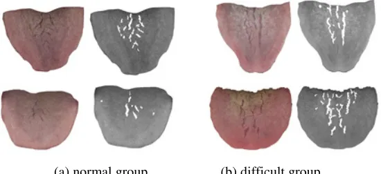 Figure 4. Results of normal group and difficult group. 