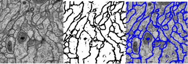Figure 2. The slice 16 of the test stack and its segmentation result. 