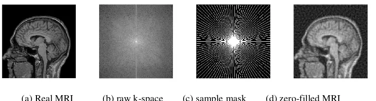 Figure 1. Artifacts caused by undersampling raw k-space data. 