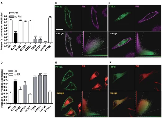 Figure 2. Subcellular localization of wild-type pendrin and its variants. (A) Pearson correlation coefficient referred to the colocalization of wild-type (WT) pendrin and its variants with the PM