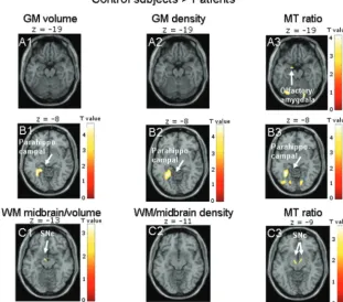 Fig 1. Results are presented at P � .001 whole-brain