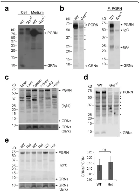 Fig. 1 Intracellular processing of PGRN.from WT and a Primary microglia from WTand Grn−/− mice were labeled with [35S]methionine and [35S]cysteinefor 24 h