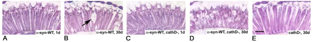Figure 8αloss of retinal architecture. tion at day 30. Scale bar, 20 human endogenous fly cathD (expressing human Cathepsin D deficiency enhances -synuclein toxicity in the retina of fly brainCathepsin D deficiency enhances α-synuclein toxicity in the reti