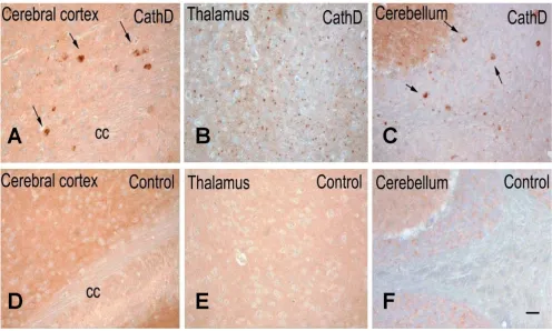 Figure 5Mice lacking ctsd gene expression exhibit intracellular α-synuclein accumulation in several regions of the brainMice lacking ctsd gene expression exhibit intracellular α-synuclein accumulation in several regions of the brain