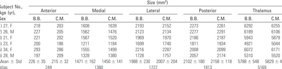 Fig 1. Comparison of the normal MPRAGE protocol (left and middle image, different windowing) with the optimized MPRAGE protocol (right).