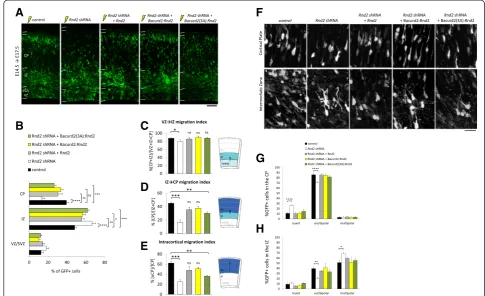 Figure 8 The defective migration ofrestored the morphologies ofcondition. Scale bar represents 100 Rnd2-deficient neurons is restored by co-delivery of Bacurd2:Rnd2