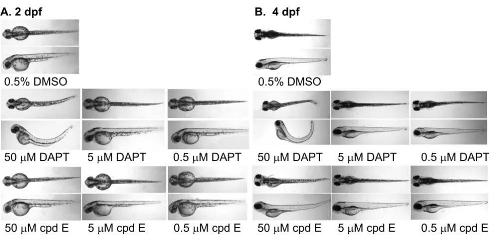 Figure 4Treatment of zebrafish embryos with DAPT causes curved tailsTreatment of zebrafish embryos with DAPT causes curved tails
