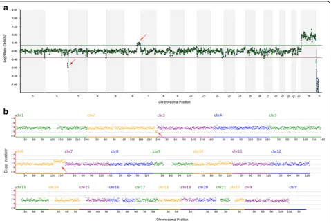 Table 1 Validation of copy number analysis by NGS