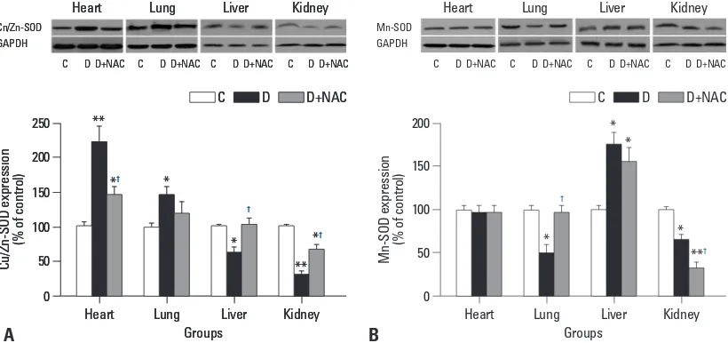 Fig. 3. Effects of N-acetylcysteine treatment on the level of total SOD activity in plasma (A) and various tissues (B)