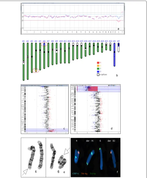 Fig. 2 Case 2. 2a: PGS profile by array CGH was normal; 2b: PGS by NGS was 46,XY.ngs 4q34.3-4q35.2(179,673,982-191,016,503×3), 6p25.3-6p22.3(146,672-17,829,693×1) (indicated by red circle); 2c, 2d: The array CGH result of the second abortion sample was arr