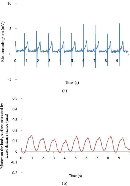 Figure 3. Sample data of subject S1 monitored for 10 seconds, extracted from the total 30 seconds of data; (a) shows the out- put signal from the ECG, (b) shows the output signal acquired by high precision CCD-laser displacement sensor