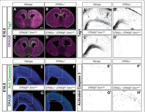 Figure 3 STRADdrastically increased in STRADα and STRADβ are redundant in axogenesis and limiting programmed cell death