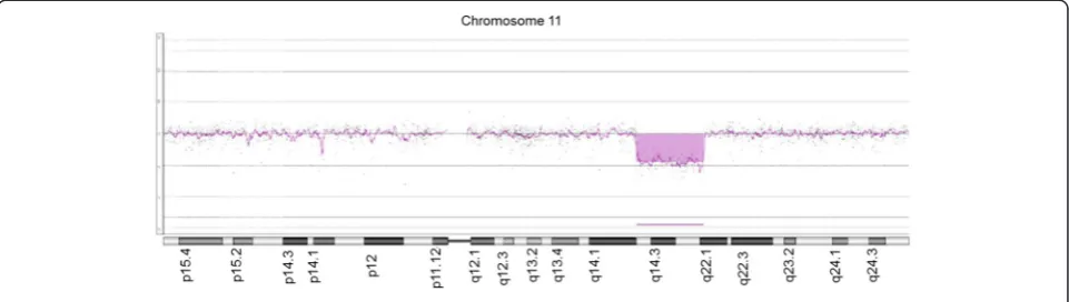Fig. 2 Ideogram of the deleted region as it is detected using array CGH. The interstitial deletion is at 11q14.2-11q22.1