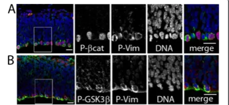 Figure 4 Targets of AKT activity are expressed in dividing(VZ). (expressed in dividing radial glial cortical precursors identified by theexpression of phosphorylated vimentin 4A4 (P-vim, pseudocoloredgreen) located at the apical (lumenal) surface of the VZ