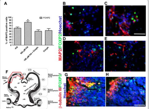 Figure 6 Chlorpheniramine prevents FOXP2 neuronal differentiation in vitro and in vivo