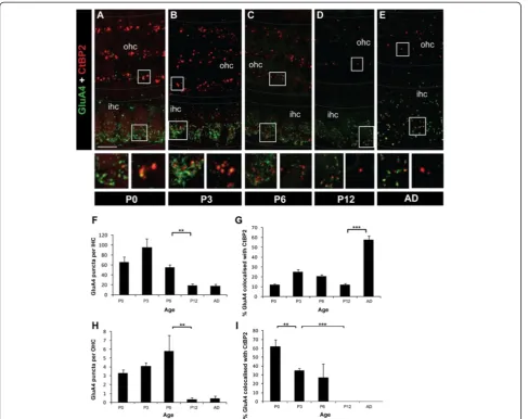 Figure 6 Changes in GluA4 subunit in IHCs and OHCs during development. A-E Example maximal projection whole-mount confocal imagesof GluA4 (green) and CtBP2 (red) immunolabelling from P0 to adult