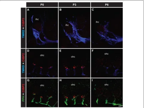 Figure 1 Visualization of synaptic ribbons during the development of the innervation of IHCs and OHCs by type I and type II afferentfibres respectively