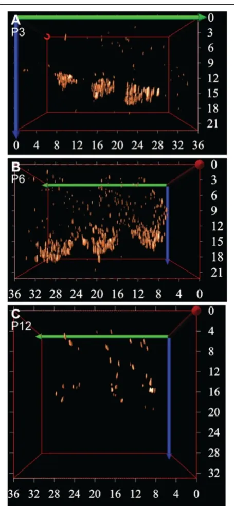Figure 3 3D reconstruction of the ribbons in OHCs duringcochlear development. A-C Confocal images of one row of wholemount cochlear preparations immunostained against CtBP2/RIBEYEat (A) P3, (B) P6, and (C) P12 were deconvolved prior to 3Dreconstruction (Im
