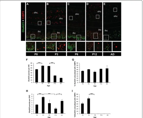 Figure 5 Changes in GluA2/3 subunits in IHCs and OHCs during development. A-E Example fluorescent whole-mount images of GluA2/3(green) and CtBP2/RIBEYE labelling (red)