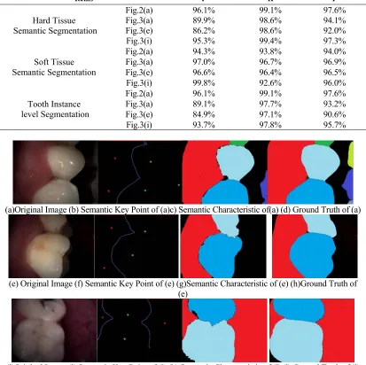 Fig.2(a) 