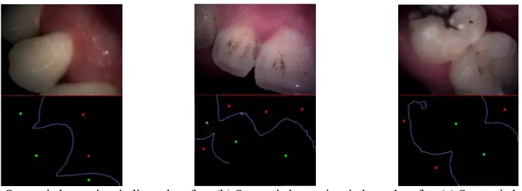 Figure 1. Dental Tissue Semantic Key Points.  