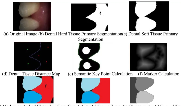 Figure 2. Dental Tissue Semantic Segmentation Results. 