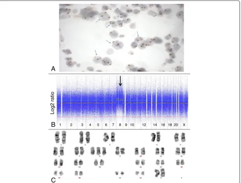 Figure 1 Trisomy 8 detected by Chromogenichybridization with probe for centromere of chromosome 8 (panel in situ hybridization, karyotyping and microarray-based genomic profiling