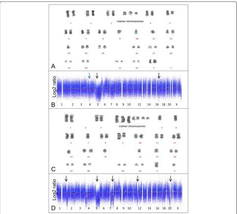 Figure 2 Comparison of karyotyping and microarray-based profiling in two patients with complex karyotypes