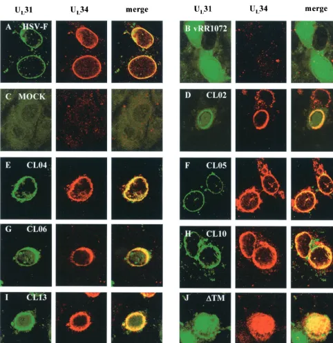 FIG. 5. Digital confocal images showing colocalization of ULplasmids encoding noncomplementing Uat 12 h postinfection, the cells were ﬁxed with cold methanol and immunostained with chicken anti-UDifferences in morphological preservation between this ﬁgure 