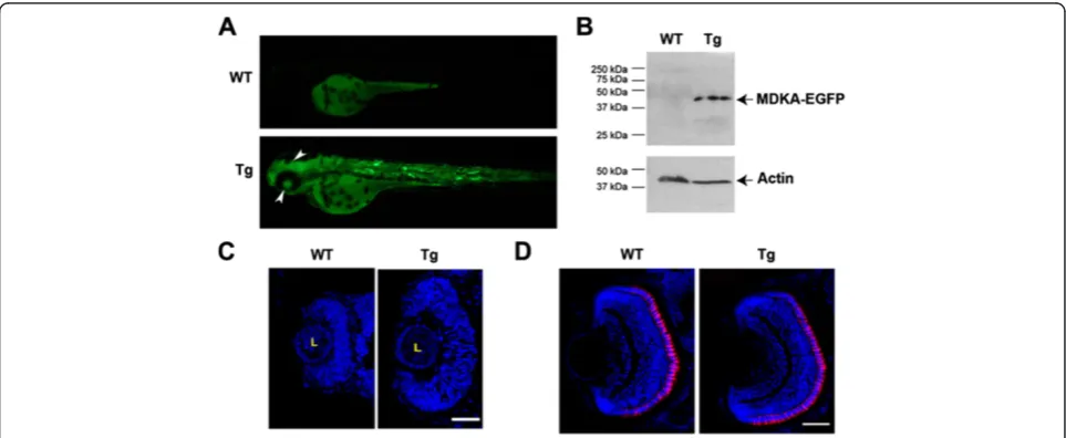 Figure 4 Conditional over-expression of Mdka. (A) Induced fluorescence in a Tg(pHSP70/4:mdka:egfp) larva at 72 hpf after heat shocktreatment at 24 hpf