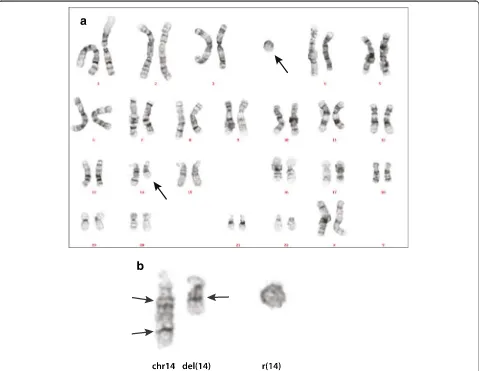 Figure 1 Chromosome analysis. a: Karyogram of the patient. b: Chromosome 14 and the r(14)