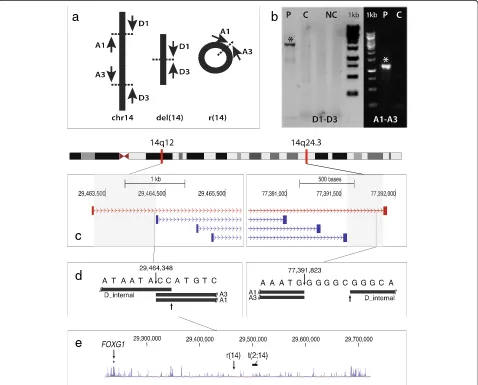 Figure 2 Molecular detection of the breakpoints. abreakpoints, with resolutions corresponding to the shaded areas (proximal: ~1,000 bp; distal: ~330 bp)